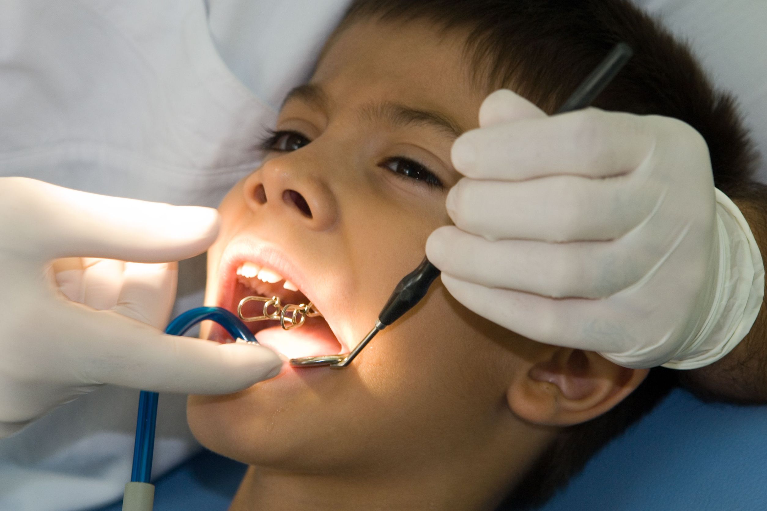 What To Expect When Your Child Sees An Orthodontist In Strongsville OH