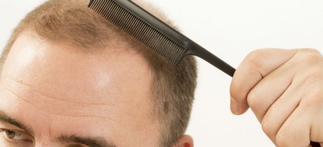 Restore a Healthy Level of Self-Esteem With Hair Restoration in Connecticut