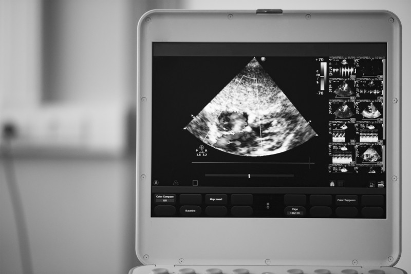 Helpful Tips for Buying an Ultrasound Machine for Your Mobile Clinic